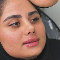 فیلر.ژل.بوتاکس،پی آر پی