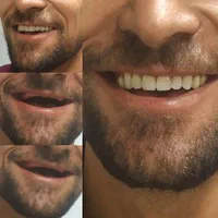 طراحی ساخت تخصصی دندان مصنوعی دیجیتال طرح لبخند|خدمات آرایشگری و زیبایی|قم, باسکول|دیوار