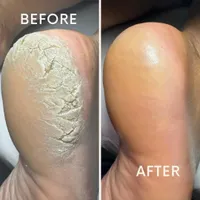 پدیکور روسی جدیدترین نوع کفسابی پا|خدمات آرایشگری و زیبایی|همدان, |دیوار