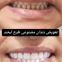 دندانپزشکی و دندانسازی پارسیان|خدمات آرایشگری و زیبایی|نسیمشهر, |دیوار