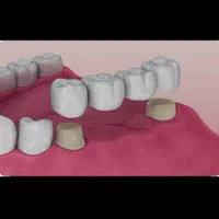 دندانپزشکی اقساطی ارتودنسی کامپوزیت ایمپلنت دندان|خدمات آرایشگری و زیبایی|مشهد, فلسطین|دیوار