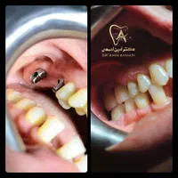 اولین مرکز دندانپزشکی دیجیتال قزوین (نقد و اقساط)