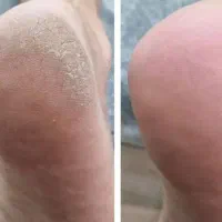 (پدیکور کف پا) کفسابی کف پا رفع ترک (ویژه بانوان)|خدمات آرایشگری و زیبایی|اصفهان, خواجه عمید|دیوار