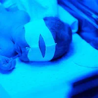 تست و اجاره دستگاه زردی و اکسیژن|خدمات آرایشگری و زیبایی|مشهد, هنرور|دیوار