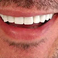 دندانپزشکی نقدواقساط باتخفیفات بینظیر فقط بمدت۷روز|خدمات آرایشگری و زیبایی|شیراز, ملاصدرا|دیوار
