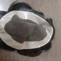 پروتز دورسیلیکن.لس انجلسی