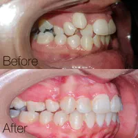 ارتودنسی ثابت ومتحرک|خدمات آرایشگری و زیبایی|شیراز, قصرالدشت|دیوار