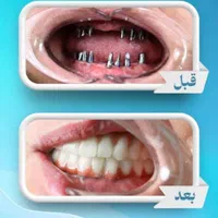 کلینیک تخصصی دندانپزشکی و ایمپلنت  در سیرجان|خدمات آرایشگری و زیبایی|سیرجان, |دیوار