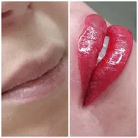 ژل بوتاکس پرسینگ تتو صورت کاشت مژه پلکسر کراتین|خدمات آرایشگری و زیبایی|مشهد, کوی سیدی|دیوار