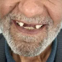 خدمات دندانپزشکی (دندانسازی با ۵ درصد تخفیف ویژه)|خدمات آرایشگری و زیبایی|زاهدان, |دیوار