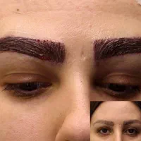کاشت مو ۳ روزه -کاشت ابرو بدون جراحی و باجراحی|خدمات آرایشگری و زیبایی|خرم‌آباد, |دیوار