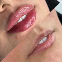 اموزش و خدمات ژل و بوتاکس با چک