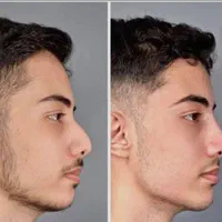 تزریق ژل و بوتاکس و کاشت نخ در کلینیک زیبایی|خدمات آرایشگری و زیبایی|خرم‌آباد, |دیوار