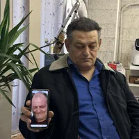 کاشت مو ابرو ریش کلینیک تخصصی اکسیر|خدمات آرایشگری و زیبایی|تبریز, |دیوار