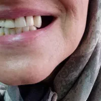 دندانسازی راشد|خدمات آرایشگری و زیبایی|مشهد, رستگار|دیوار