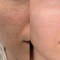 آموزشی تخصصی مراقبت و پاکسازی پوست|خدمات آموزشی|رشت, دیلمان|دیوار