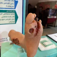 درمان تخصصی زخم/پرستاری درمنزل/تزریقات/سرم|خدمات آرایشگری و زیبایی|تهران, چیتگر جنوبی|دیوار