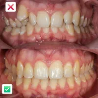 دندانپزشکی (ارتودنسی)