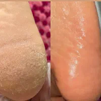 پاکسازی و فیشیال تخصصی پوست|خدمات آرایشگری و زیبایی|اصفهان, همدانیان|دیوار