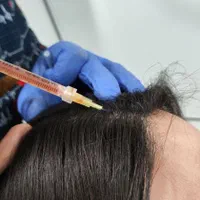 تزریق ژل وبوتاکس و لیزر موی زایدولیزر پاک کردن تتو|خدمات آرایشگری و زیبایی|نسیم‌شهر, |دیوار