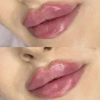 جشنواره لب فیلر ژل روسی بوتاکس زاویه سازی مادلینگ|خدمات آرایشگری و زیبایی|کرج, گوهردشت|دیوار