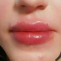 جشنواره ژل و لیزر کلینیک دکتر قاسمی|خدمات آرایشگری و زیبایی|قم, کیوانفر|دیوار