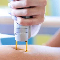 دستگاه لیزر مو کندلا و رولی سه طول موج تاسیس مطب|آرایشی، بهداشتی، درمانی|تهران, جردن|دیوار