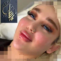 تزریق ژل وبوتاکس ومادلینگ اروپایی وهایفو درکلینیک|خدمات آرایشگری و زیبایی|کرمانشاه, |دیوار