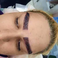 تزریق ژل و بوتاکس در تمام ایام حتی روزهای تعطیل|خدمات آرایشگری و زیبایی|فردیس, |دیوار