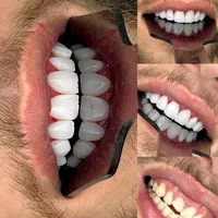 کامپوزیت/لمینت/ایمپلنت/روکش|خدمات آرایشگری و زیبایی|تهران, ستارخان|دیوار