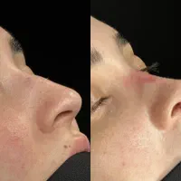 عمل حراحی زیبایی بینی گوش لیفت صورت اندام|خدمات آرایشگری و زیبایی|تهران, نیروی هوایی (پیروزی)|دیوار