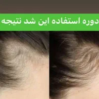 تنها دفتر پخش تونیک هیرفرند گیاهی(ضدریزش، رویش مو)|آرایشی، بهداشتی، درمانی|مشهد, جنت|دیوار
