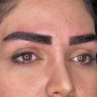 مدل کاشت مو و ابرو تضمینی