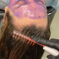 پاکسازی فیشیال صورت همراه آنالیزپوست،لیفت ابرو|خدمات آرایشگری و زیبایی|کرج, گوهردشت|دیوار