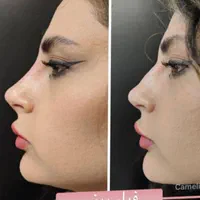 کلینیک لیزر و زیبایی دکتر اکرم درویش زاده|خدمات آرایشگری و زیبایی|زاهدان, |دیوار