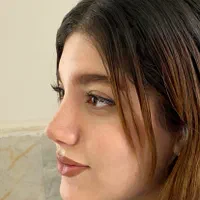 عمل جراحی بینی با بوتاکس رایگان فقط ۲۶،بدون تامپون|خدمات آرایشگری و زیبایی|تهران, یوسف‌آباد|دیوار