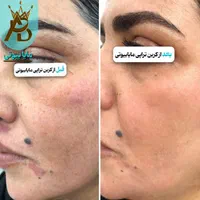 اولین مرکز روشن کننده بیکینی و زیربغل،مایابیوتی|خدمات آرایشگری و زیبایی|یاسوج, |دیوار