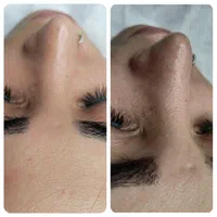 پاکسازی و فیشال تخصصی|خدمات آرایشگری و زیبایی|شاهین‌شهر, فردوسی|دیوار