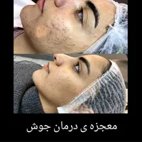 ۵۰ درصد تخفیف ویژه فیشال به مدت ۳ روز|خدمات آرایشگری و زیبایی|اهواز, کیانپارس |دیوار