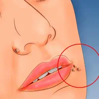 زگیل و تبخال تناسلی/دست/صورت/خال گوشتی و رنگی