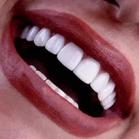 خدمات دندان پزشکی لمینت و کامپوزیت زیبایی|خدمات آرایشگری و زیبایی|تهران, جمهوری|دیوار