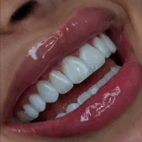 تخفیف ویژه فقط تا پایان هفته