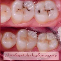 کلیه امور دندانپزشکی دکتر شفاعی