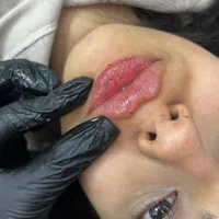 تزریق ژل و بوتاکس تخفیف بهاره ۳۹۹|خدمات آرایشگری و زیبایی|تهران, نازی‌آباد|دیوار