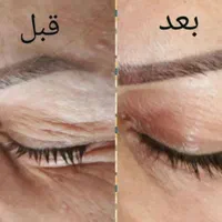 جشنواره تخصصی تضمین پلکسربوتاکس ژل مزونیدلین پرسین|خدمات آرایشگری و زیبایی|مشهد, سید رضی|دیوار