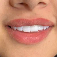 کامپوزیت دندان ، اصلاح طرح لبخند|خدمات آرایشگری و زیبایی|اصفهان, خواجو|دیوار