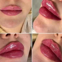 جشنواره تزریق ژل و بوتاکس وفیلر زیر چشم|خدمات آرایشگری و زیبایی|تهران, مرزداران|دیوار