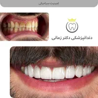 ارتودنسی نامرئی به روش دیجیتالی|خدمات آرایشگری و زیبایی|تهران, امیریه|دیوار
