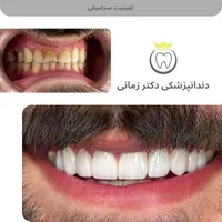 ارتودنسی نامرئی به روش دیجیتالی|خدمات آرایشگری و زیبایی|تهران, امیریه|دیوار