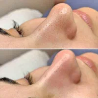 فیشیال(فیشال) و پاکسازی تخصصی